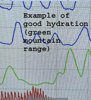 polygraph lie detector test in Los Angeles where examinee is not dehydrated